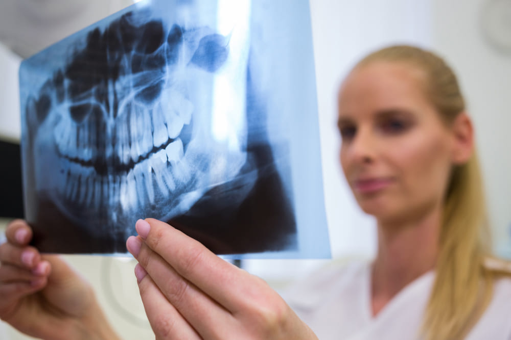 cirugia_de_fracturas_faciales_en_ciudad_de_mexico.jpg