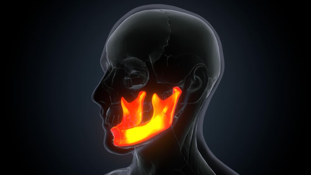 cirugia_de_maxilar_inferior_en_ciudad_mexico.jpg