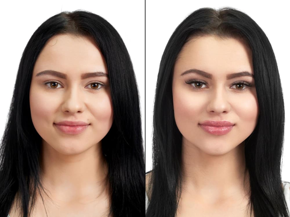 cirugia_de_perfil_facial_en_ciudad_de_mexico.jpg