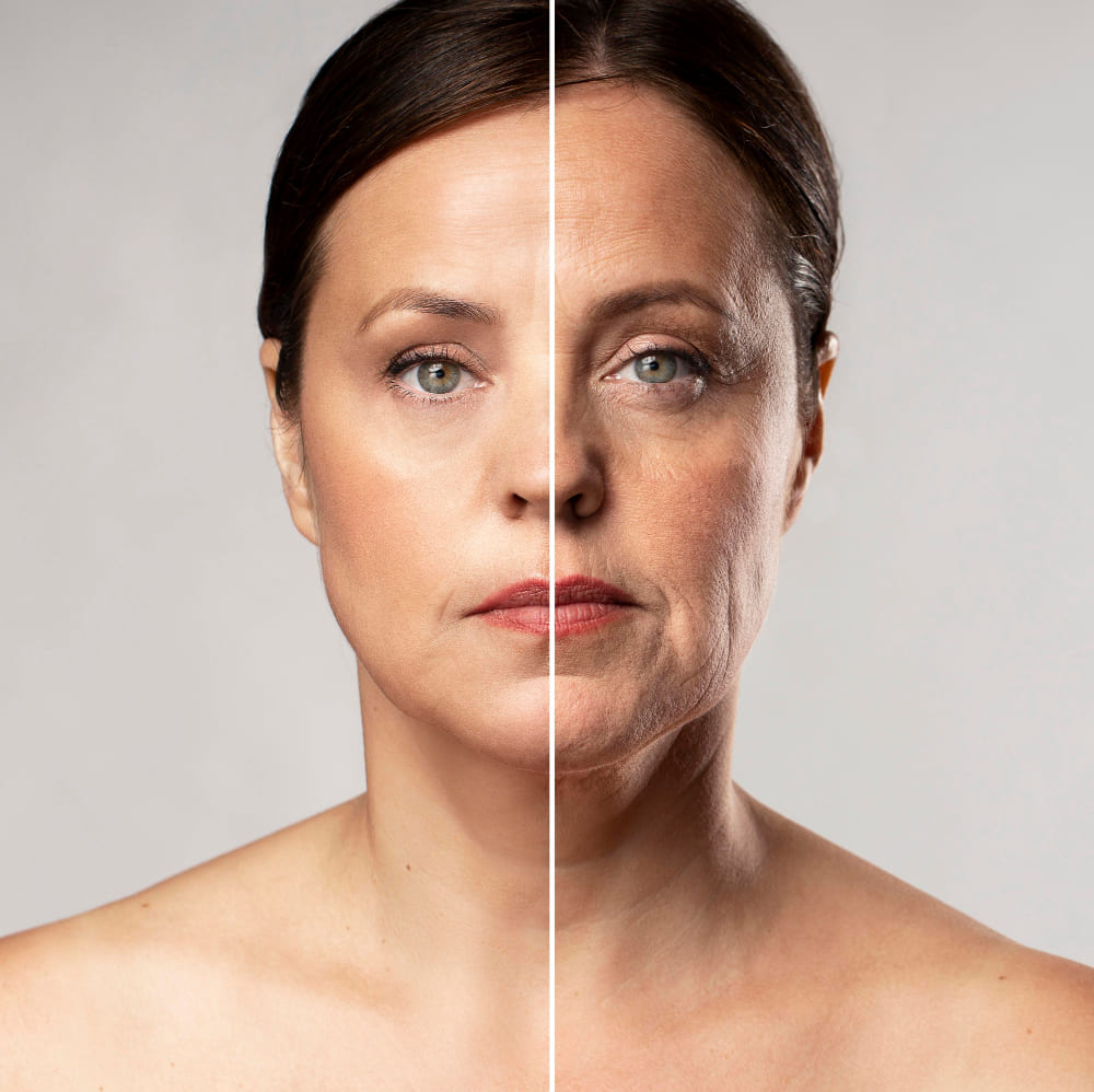 cirugia_de_rejuvenecimiento_facial_en_ciudad_de_mexico.jpg