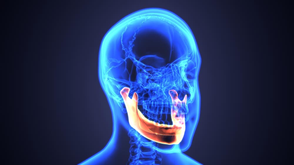 cirugia_funcional_maxilofacial_ciudad_mexico.jpg