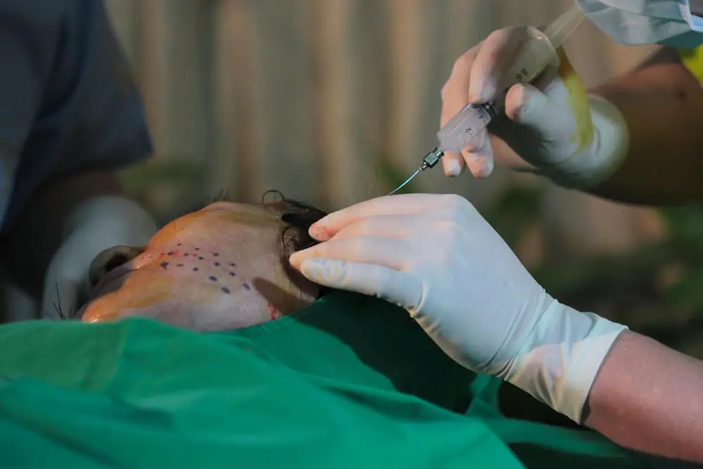 cuanto-cuesta-una-operacion-de-mandibula-en-iztapalapa-cdmx.webp