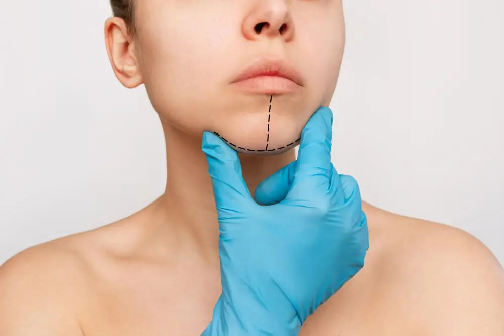 implante-mandibular-precio-en-iztapalapa-cdmx.webp