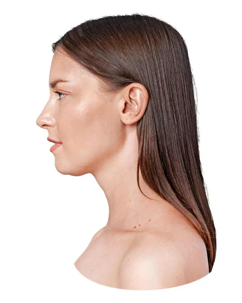 reduccion-de-mandibula-precio-en-iztapalapa-cdmx.webp
